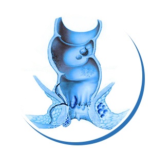 Hemosens-h Hemosens-h